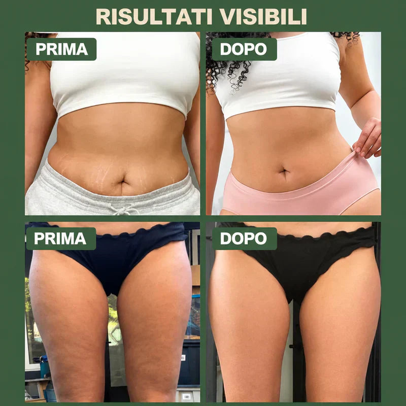 Coppette Sottovuoto Anticellulite